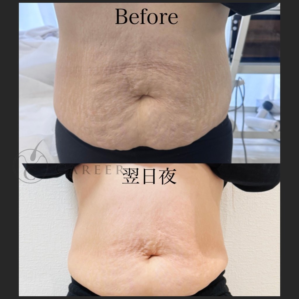 ノアグロウ】レモンボトル | カリアスカルプ 頭髪スペシャリスト【頭髪