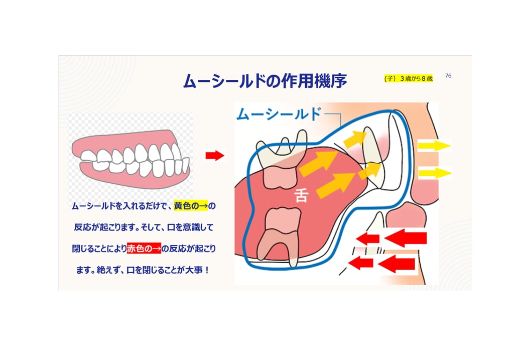 おうち矯正 小児矯正・MRC矯正 東住吉区北田辺の歯医者 田治米歯科医院 子供
