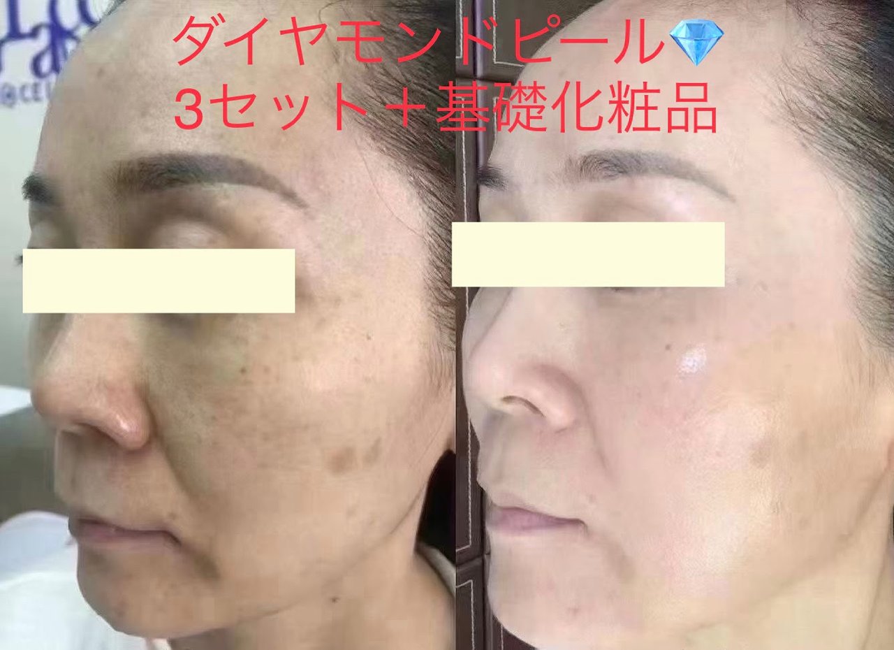 よくある質問 | Rene-cell化粧品池袋体験店 よくある質問 | Rene-cell化粧品池袋体験店