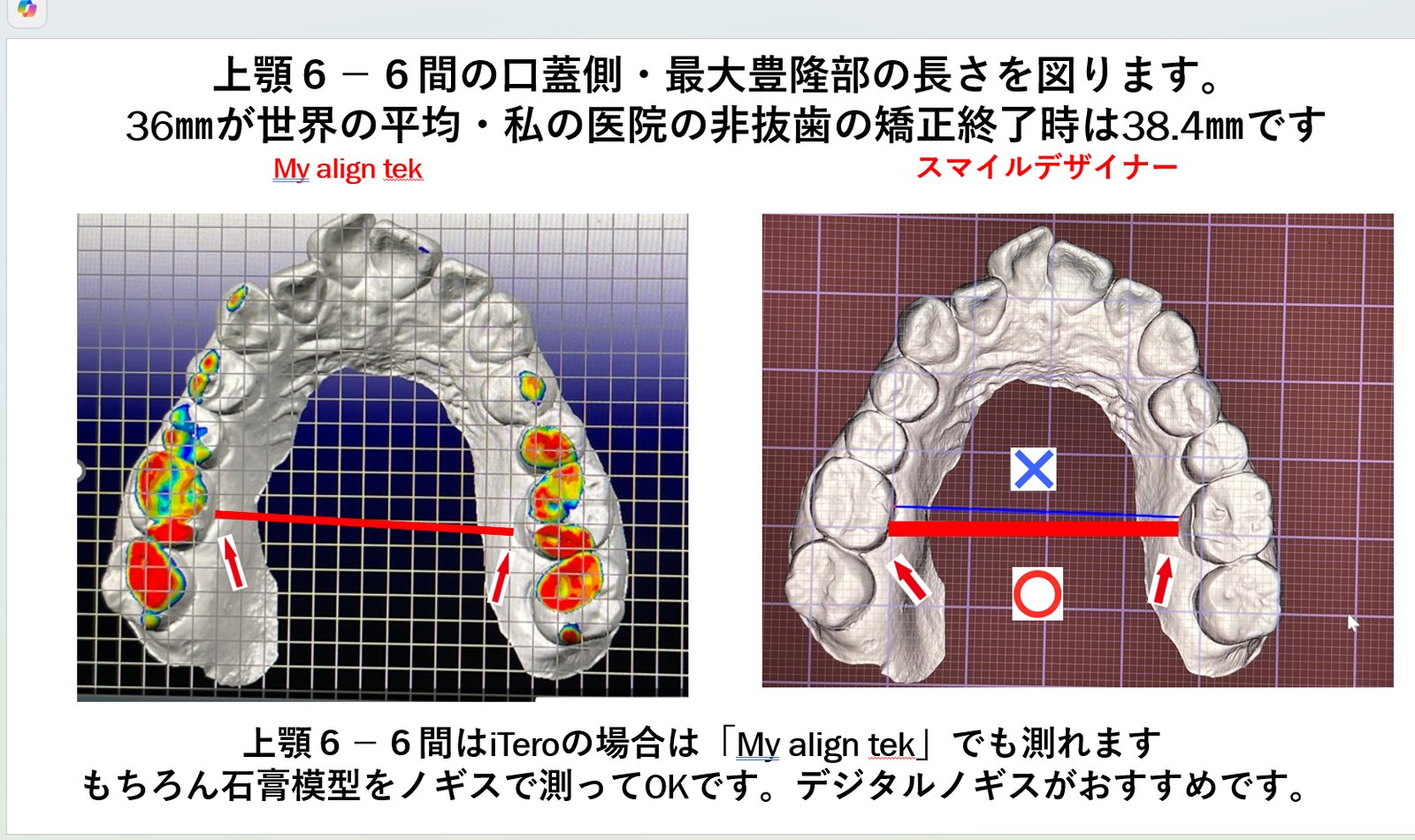 ④・小児歯科 | 頭蓋の骨格から直す小児矯正です！