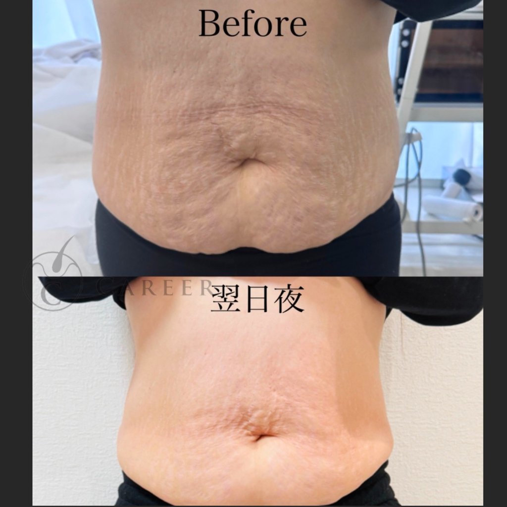 ノアグロウ】レモンボトル | カリアスカルプ 頭髪スペシャリスト